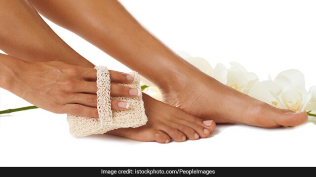 Try these home remedies to fight cracked heels