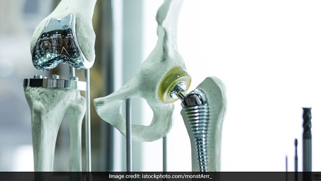 A cellulose nanocrystal aerogel can support new bone growth: study