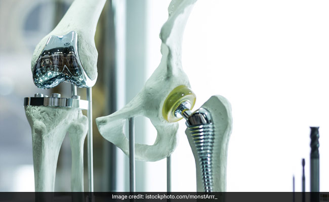 A cellulose nanocrystal aerogel can support new bone growth: study