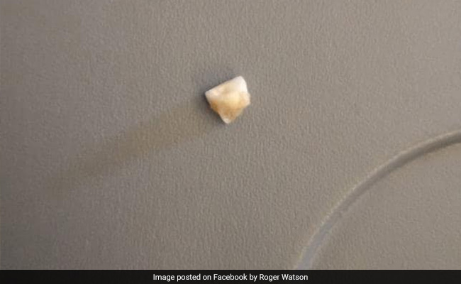 फ्लाइट में शख्स ने ऑर्डर किए चावल, दांतों में फंसी ऐसी चीज़ जिसे देख उड़ गए होश...