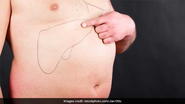 Fatty Liver होने पर क्या खाना चाहिए, यहां देखिए पूरी लिस्ट फिर नहीं होगी फैटी लिवर की समस्या