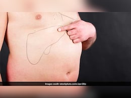 Fatty Liver होने पर क्या खाना चाहिए, यहां देखिए पूरी लिस्ट फिर नहीं होगी फैटी लिवर की समस्या Fatty Liver होने पर क्या खाना चाहिए, यहां देखिए पूरी लिस्ट फिर नहीं होगी फैटी लिवर की समस्या
