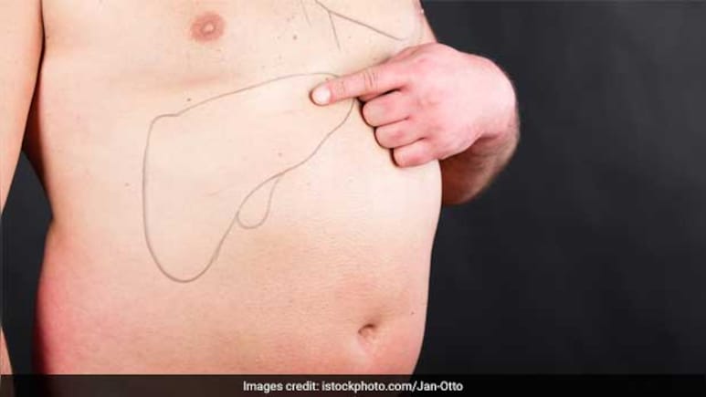 Fatty Liver होने पर क्या खाना चाहिए, यहां देखिए पूरी लिस्ट फिर नहीं होगी फैटी लिवर की समस्या Fatty Liver होने पर क्या खाना चाहिए, यहां देखिए पूरी लिस्ट फिर नहीं होगी फैटी लिवर की समस्या