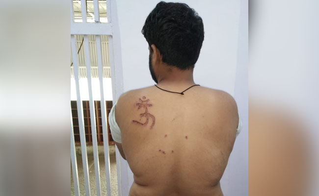Prisoner Alleges Tihar Jail Superintendent Branded 'Om' On His Back