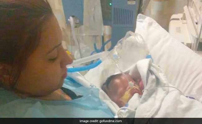 Baby Was Born With Nearly No Skin. Doctors Are Fighting To Keep Him Alive