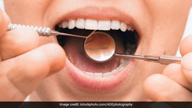 Oral Health: Here's How Dental Hygiene Helps Reduce Risk Of Chronic Diseases