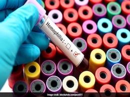 World Hemophilia Day 2024: Know Theme, Significance And Some Facts About This Bleeding Disorder World Hemophilia Day 2024: Know Theme, Significance And Some Facts About This Bleeding Disorder