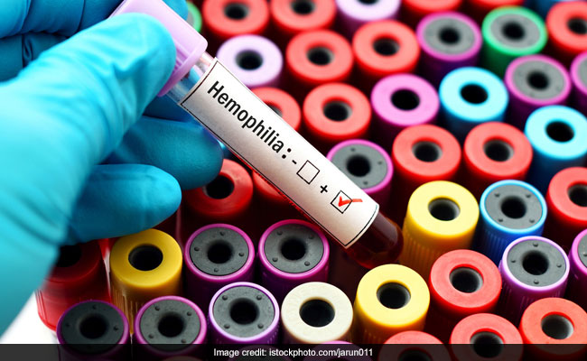 The theme for World Hemophilia Day 2024 is "Equitable access for all: recognizing all bleeding disorders"