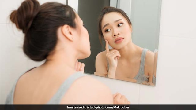 Hyperpigmentation is accumulation of abnormal proteins on the skin