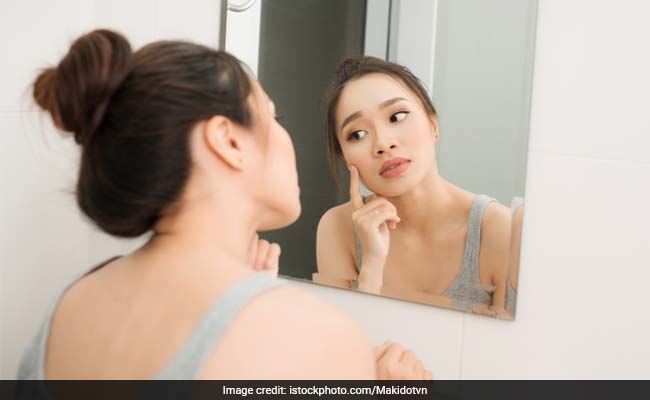 Hyperpigmentation is accumulation of abnormal proteins on the skin