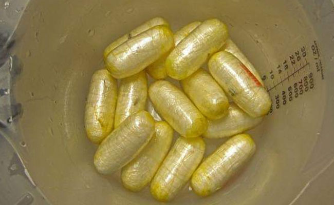 पेट के अंदर 5 करोड़ रुपये के 65 कैप्सूल लेकर आया था विदेशी, डॉक्टर्स ने किया X-Ray तो रह गए हैरान