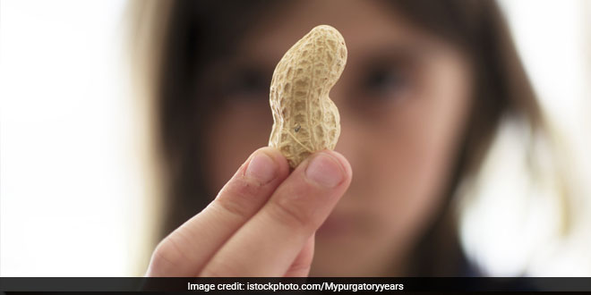 लड़की को परोसी मूंगफली, तो ब्रिटेन में भारतीय रेस्टोरेंट पर लगा 3.5 लाख का जुर्माना