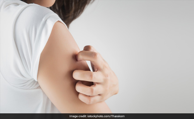 Chronic Itching: Top Causes, Symptoms And Treatment Options
