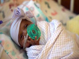 World's Tiniest Baby, Light As An Apple, Born In California World's Tiniest Baby, Light As An Apple, Born In California