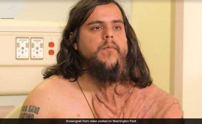 Rare Skin Disease Left Him Isolated. Surgery Gave Him Back His Life