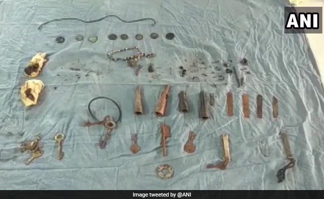 80 Objects Including Keys, Chains Removed From Man's Stomach In Rajasthan