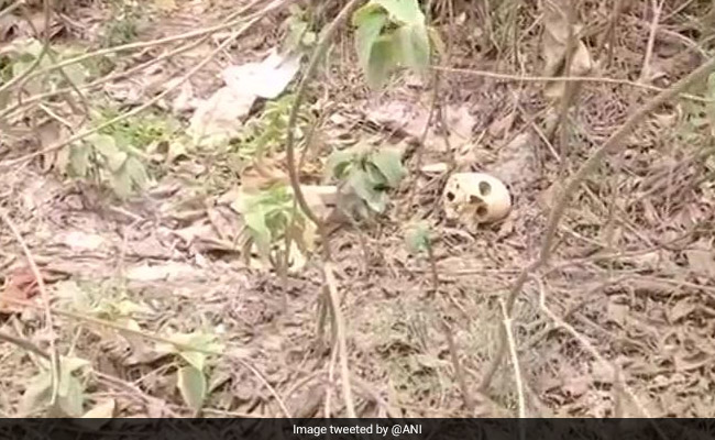 Human Skeletons Found Dumped Near Hospital In Bihar's Muzaffarpur