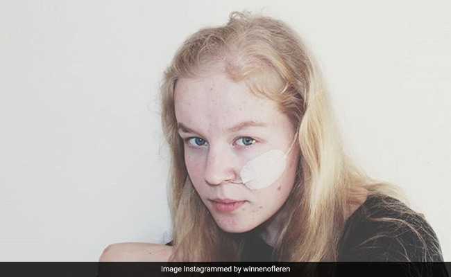 Dutch Teen, Traumatised By Rape, Died After Refusing Food: Minister