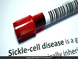 World Sickle Cell Day: Causes, Symptoms And Survival Rate Of This Common Genetic Disease World Sickle Cell Day: Causes, Symptoms And Survival Rate Of This Common Genetic Disease