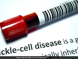All You Need To Know About Sickle Cell Disease