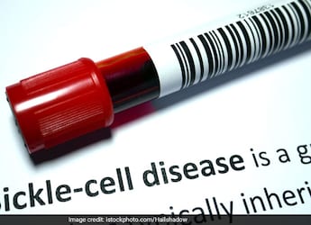 All You Need To Know About Sickle Cell Disease