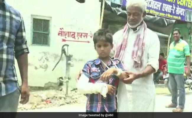 Bihar Boy Gets His Left Hand Fractured, Doctors Cast Plaster On Right