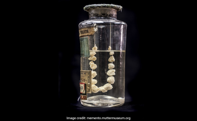 Museum’s Exhibit Of Tumours, Skulls Is Curated Peek Into A Bizarre World