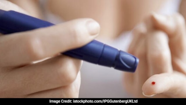 Hair loss and thinning hair can indicate insulin resistance