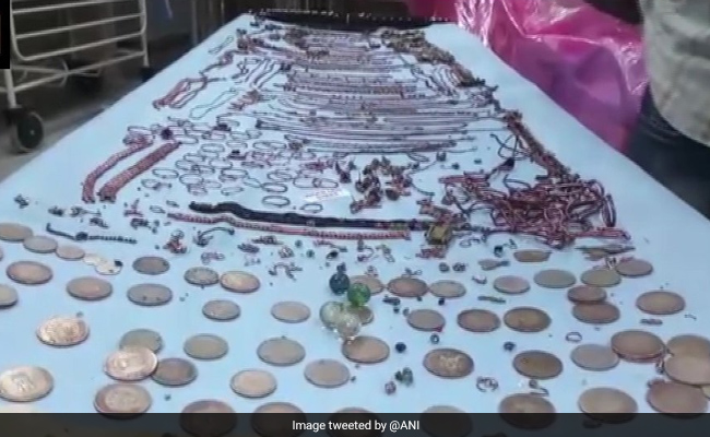 1.5 Kg Jewellery, Coins Removed From Woman's Stomach In Bengal