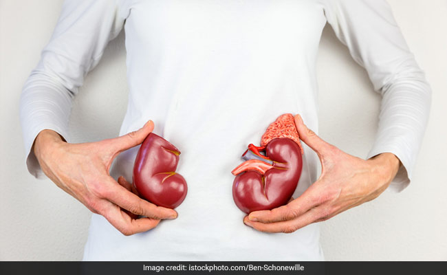 World Kidney Day 2020: Kidney stones, if not treated, may lead to kidney failure
