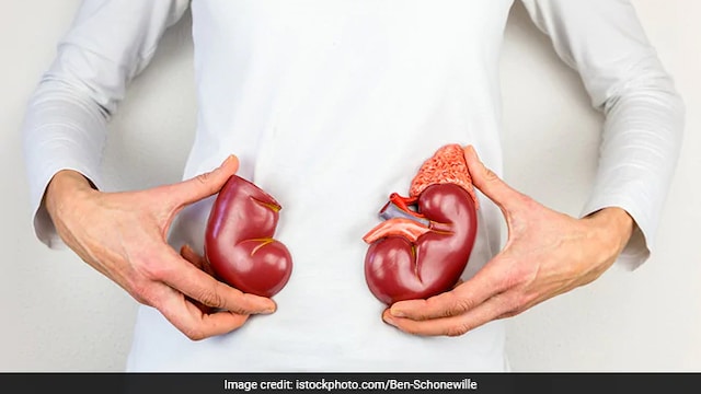 Kidney patients choose home dialysis during the pandemic, says expert