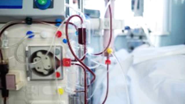 Dialysis helps people suffering from kidney failure get rid of toxins from the body