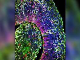 Human-Like Neural Activity Detected In Lab Grown Mini Brains Human-Like Neural Activity Detected In Lab Grown Mini Brains