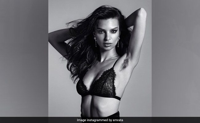 Supermodel Shows Off Armpit Hair In Powerful Photoshoot