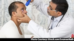 Cataract Vs Age-Related Macular Degeneration: How To Tell The Difference