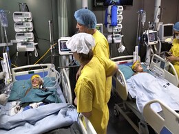 Conjoined Bangladeshi Twins Who Were Separated Are Stable, Say Doctors Conjoined Bangladeshi Twins Who Were Separated Are Stable, Say Doctors