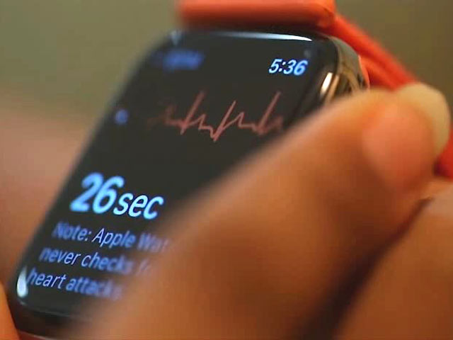 Apple Brings ECG to India