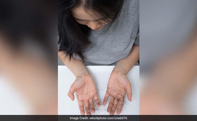 Iron deficiency, which causes hair loss, may go undetermined for years