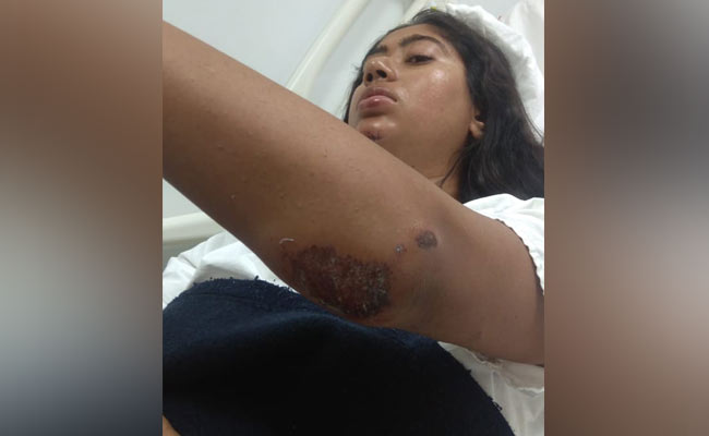 Arvind Kejriwal Condemns Attack On Delhi Journalist By Thieves
