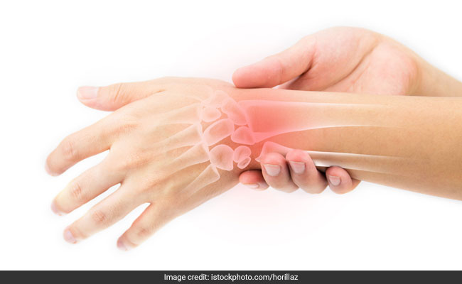 World Arthritis Day 2020: Expert Explains The Importance Of Early Diagnosis