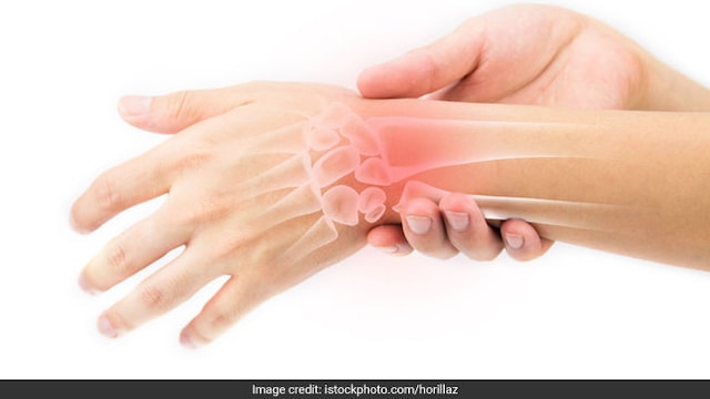 This neurological condition usually affects young males