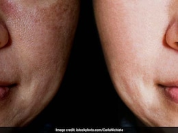 लैवेंडर ऑयल में मिलाकर चेहरे पर लगा लें ये चीज, लटकती स्किन हो जाएगी टाइट, गायब हो जाएंगी झुर्रियां