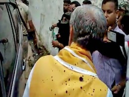 "Ink Thrown On Democracy," Says Minister, Attacked At Patna Hospital "Ink Thrown On Democracy," Says Minister, Attacked At Patna Hospital