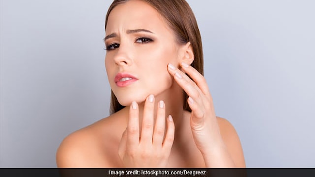 Tips for Skincare: Cover your face as much as possible before going out
