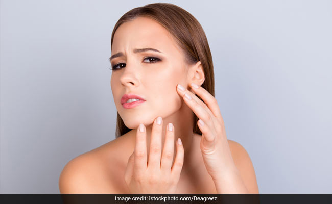 Tips for Skincare: Cover your face as much as possible before going out