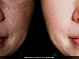 बढ़ती उम्र का असर रुक जाएगा! रोज खा लें डाइटिशियन के बताए 7 Anti-Ageing Food, 40 में भी दिखेंगे 25 जैसे बढ़ती उम्र का असर रुक जाएगा! रोज खा लें डाइटिशियन के बताए 7 Anti-Ageing Food, 40 में भी दिखेंगे 25 जैसे