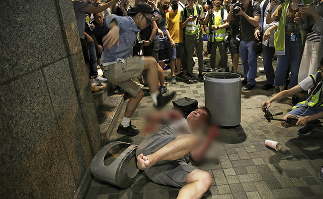 Hong Kong Mall Clash Ends In Knife Attack, Politician's Ear Bitten Off