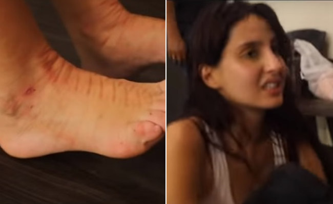 नोरा फतेही दर्द से कराह रही थीं, फिर भी नहीं छोड़ा डांस करना- Video देख कहेंगे OMG! नोरा फतेही दर्द से कराह रही थीं, फिर भी नहीं छोड़ा डांस करना- Video देख कहेंगे OMG!