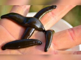 शरीर से जोंक चिपक जाएं तो ऐसे हटाएं, क्या नमक का इस्तेमाल करना है सही?