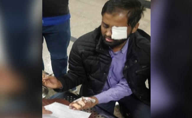 "20-25 Armed Cops Burst In...": Jamia Student Who Lost Sight In Left Eye